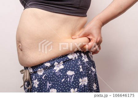 【お腹の肉を摘む主婦とでべそ】 【お腹の肉を摘む主婦とでべそ】 106646175