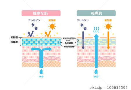 健康な肌と乾燥肌の皮膚断面 比較イラスト 106655595