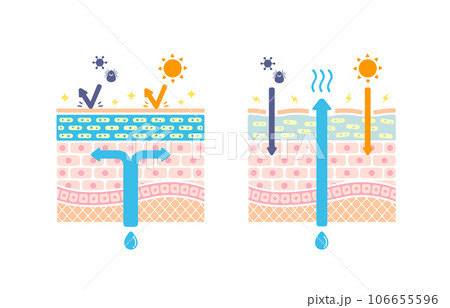 健康な肌と乾燥肌の皮膚断面 比較イラスト  (文字なし) 106655596