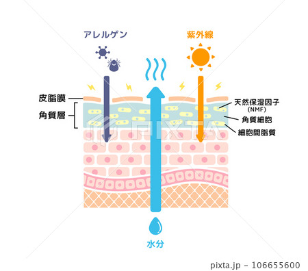 乾燥肌の皮膚断面 イラスト   106655600