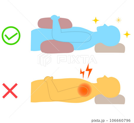 肩が痛い時の眠る姿勢の解説　クッションで固定 106660796