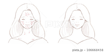 ニキビに悩む女性と完治した女性 背景透明の線画 ニキビに悩む女性と完治した女性 背景透明の線画 106668438
