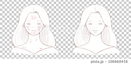 ニキビに悩む女性と完治した女性 背景透明の線画 ニキビに悩む女性と完治した女性 背景透明の線画 106668438