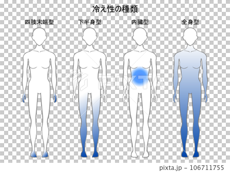 對寒冷敏感的類型 106711755