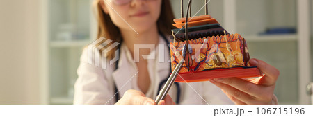 Young female dermatologist holds pen and anatomical model of human skin with hair. Young female dermatologist holds pen and anatomical model of human skin with hair. 106715196