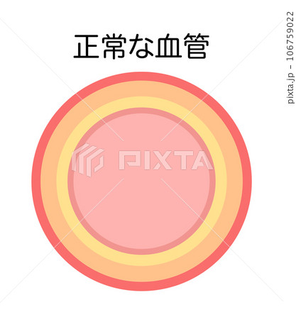 動脈硬化がない正常な血管の縦断面図のイラスト 106759022
