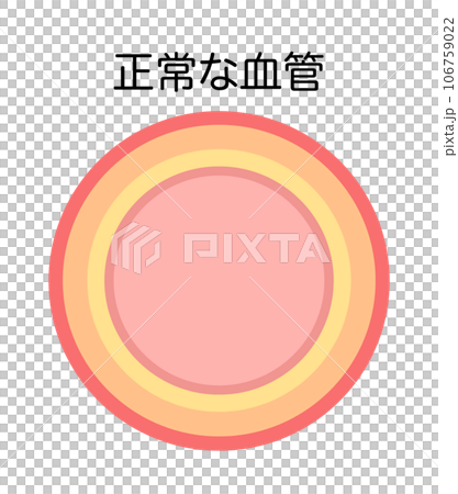 動脈硬化がない正常な血管の縦断面図のイラスト 106759022