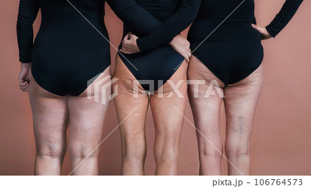 Rear view of three senior friends holding each other, close up on female legs. Rear view of three senior friends holding each other, close up on female legs. 106764573