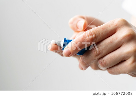 手荒れ 皮膚疾患 手荒れ 皮膚疾患 106772008