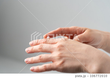 手荒れ　皮膚疾患 106772010
