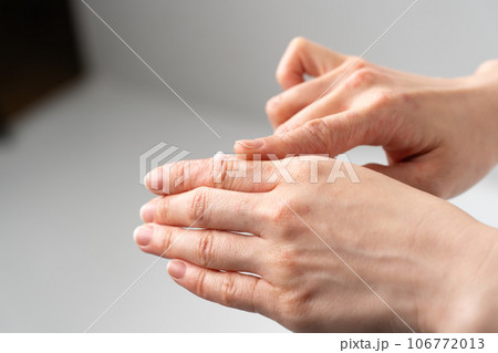 手荒れ 皮膚疾患 手荒れ 皮膚疾患 106772013