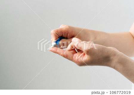 手荒れ　皮膚疾患 106772019