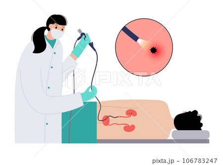 Ureteroscopy medical poster 106783247