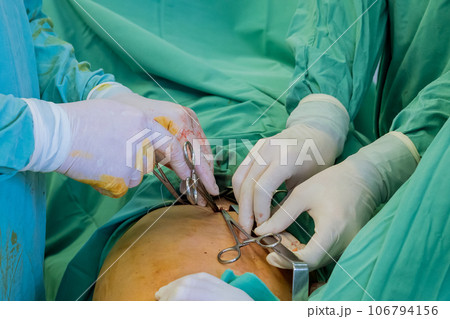 Leg surgeries are conducted by orthopedic doctors to address injuries sustained by a patient. 106794156