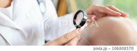 Female doctor checks scalp of bald male patient while looking through magnifying glass. 106808570
