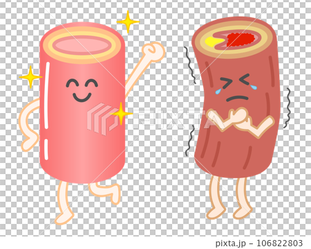 Illustration with facial expressions of healthy blood vessels and blood vessels occluded by arteriosclerosis 106822803