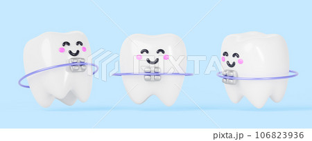 Teeth with metal dental braces on blue background 3d render icon set. Cartoon smiling kawaii characters, cute baby tooth with brackets and arch wire, orthodontic treatment concept. 3D illustration Teeth with metal dental braces on blue background 3d render icon set. Cartoon smiling kawaii characters, cute baby tooth with brackets and arch wire, orthodontic treatment concept. 3D illustration 106823936