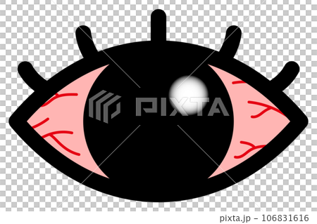 充血している目 106831616