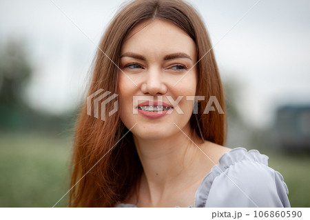The smile of a young and beautiful girl with braces on her white teeth. Straightening of crooked teeth with the help of a bracket system. Malocclusion. Dental care. Smooth teeth and a beautiful smile 106860590