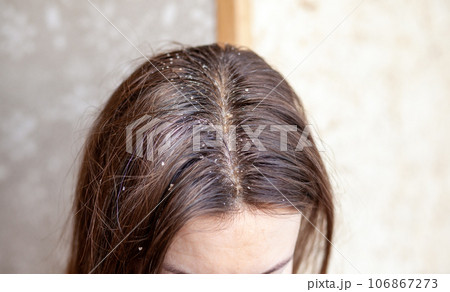 Parting of women's hair on the head. Hair care and care. Closeup of a woman's head with parted gray hair regrown roots becouse of quarantine Parting of women's hair on the head. Hair care and care. Closeup of a woman's head with parted gray hair regrown roots becouse of quarantine 106867273