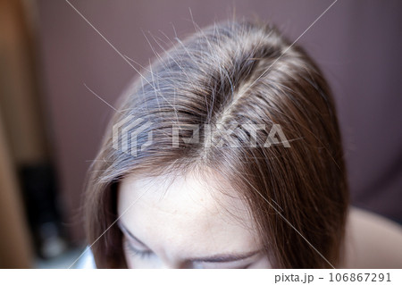 Parting of women's hair on the head. Hair care and care. Closeup of a woman's head with parted gray hair regrown roots becouse of quarantine 106867291