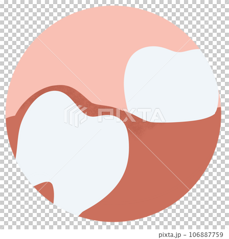 Tooth wisdom decay caries toothache dental...のイラスト素材 [106887759] - PIXTA