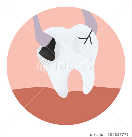 Tooth extraction anatomy decay caries toothache dental dentist healthcare circle icon 106887771