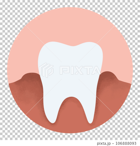 Tartar and bactrail tooth plaque, lower jaw. Medically accurate  illustration of human teeth treatment 106888093