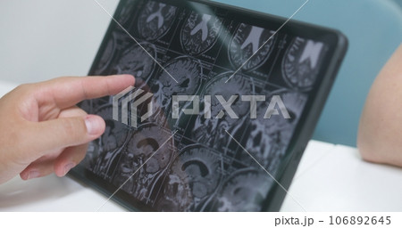 Professional doctor looks at image of MRI scan on digital tablet 106892645