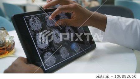 Professional medic examines brain scanning in hospital canteen 106892650