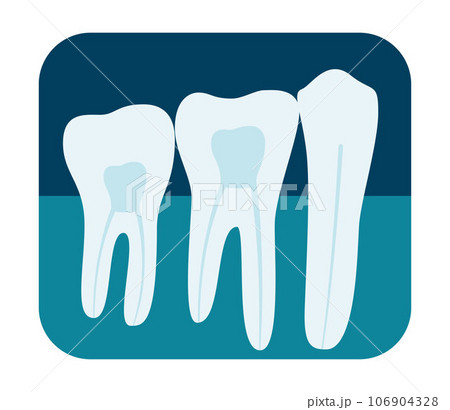 X-ray of human teeth. Three healthy molars on an x-ray. Vector illustration. X-ray of human teeth. Three healthy molars on an x-ray. Vector illustration. 106904328
