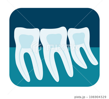 X-ray of human teeth. Three healthy molars on an x-ray. Vector illustration. X-ray of human teeth. Three healthy molars on an x-ray. Vector illustration. 106904329