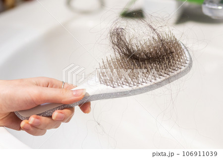 Close-up of female hand holding comb with big clump of lost hair over sink. Concept of baldness and alopecia 106911039