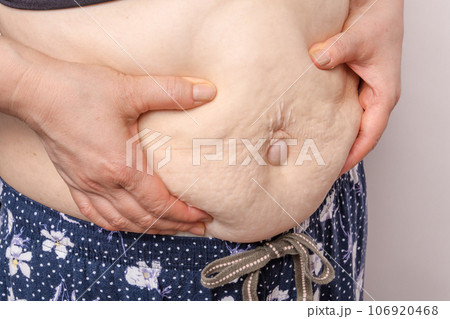 【お腹の肉を摘む主婦とでべそ】 【お腹の肉を摘む主婦とでべそ】 106920468