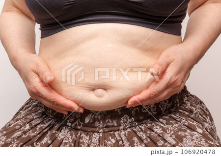 【お腹の肉を摘む主婦とでべそ】 【お腹の肉を摘む主婦とでべそ】 106920478
