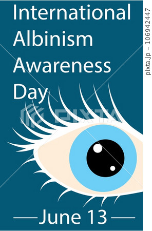 International Albinism Awareness Day. Female eye with white eyelashes. Genetic rare disorder. International Albinism Awareness Day. Female eye with white eyelashes. Genetic rare disorder. 106942447