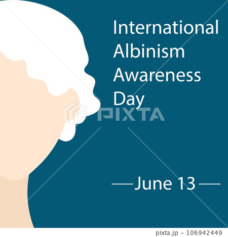 International Albinism Awareness Day. Girl with white wavy hair. Genetic rare disorder. International Albinism Awareness Day. Girl with white wavy hair. Genetic rare disorder. 106942449