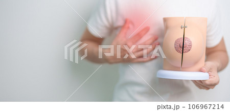 Woman holding Chest pain with Breast Anatomy model. Breast Augmentation Surgery, October Breast Cancer Awareness month, checking, Diagnosis, Beauty woman enlargement, Disease and medical concept Woman holding Chest pain with Breast Anatomy model. Breast Augmentation Surgery, October Breast Cancer Awareness month, checking, Diagnosis, Beauty woman enlargement, Disease and medical concept 106967214