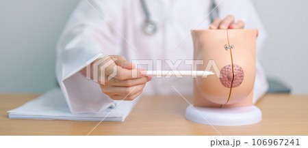 Doctor with Breast Anatomy model. Breast Augmentation Surgery, October Breast Cancer Awareness month, implant, Diagnosis, Beauty woman enlargement and medical education concept 106967241