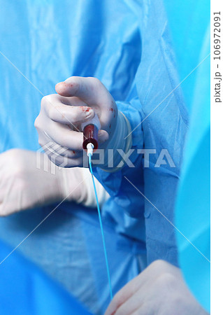 Endovascular surgery. Surgery on blood vessels. Surgical interventions on blood vessels.Concept of healthcare.Vertical photo. 106972091