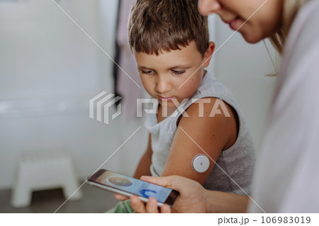 Mother of diabetic boy checking his blood glucose level at home using continuous glucose monitor. Mother of diabetic boy checking his blood glucose level at home using continuous glucose monitor. 106983019