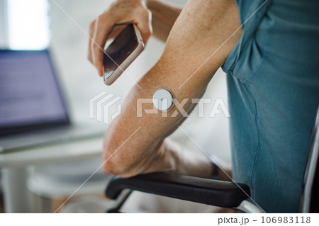 Diabetic senior man checking blood glucose level at home using continuous glucose monitor. 106983118
