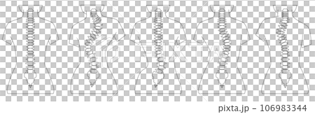 側湾症の背骨のシンプルなイラスト 106983344