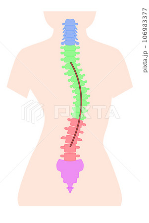 側湾症の背骨のシンプルなイラスト 106983377