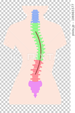 脊椎側彎的簡單圖示 脊椎側彎的簡單圖示 106983377