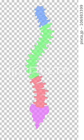A simple illustration of a scoliotic spine A simple illustration of a scoliotic spine 106983399