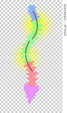 A simple illustration of a scoliotic spine 106983400
