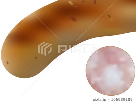 「焼いたソーセージ」と「輪切りのソーセージ」 106989189