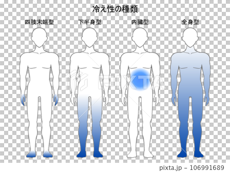 List of types of sensitivity to cold 106991689