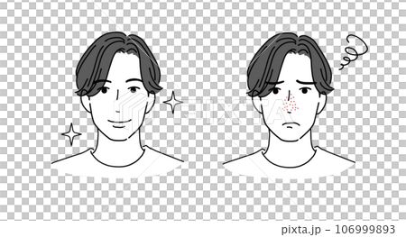 一個為毛孔煩惱的男人和一個解決問題後微笑的男人 106999893